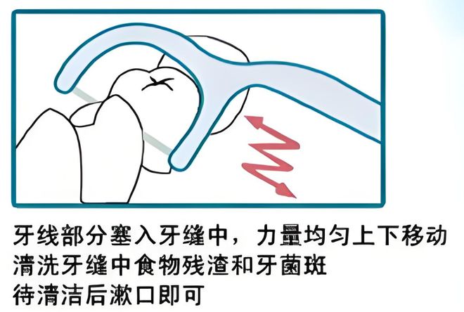 卫生习惯--小鹿妈妈牙线龙8国际唯一年夜饭后的(图2)